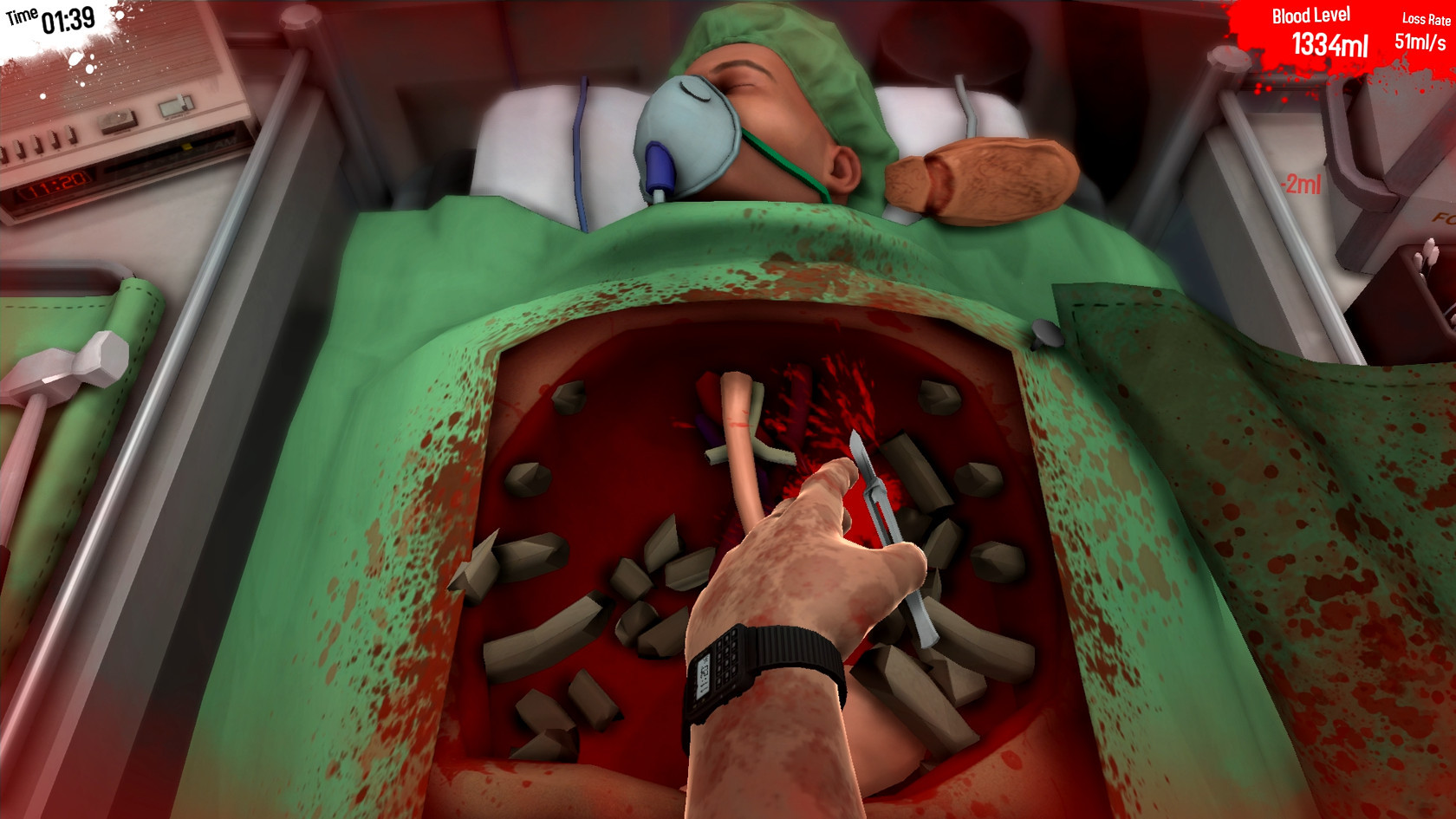 Surgeon Simulator Download For Mac Surgeon Simulator Download For Mac